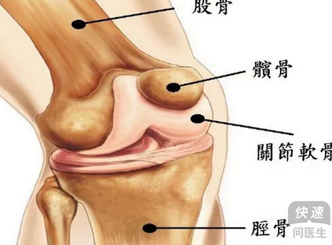 老人常喝汤引发痛风石，膝关节惊现三十余颗结石病例！