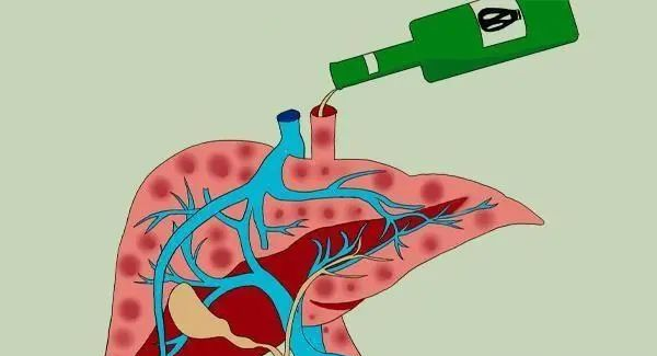 男子因过度饮酒导致肝衰竭，生活与工作的警示警醒世人